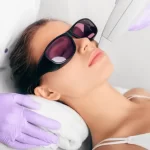 Laser Hair Removal